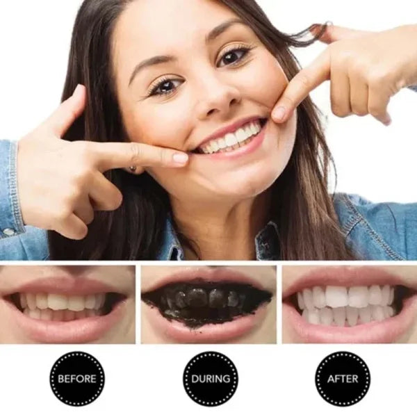 Teeth Whitening Charcoal Powder (Organic) – Natural Activated Charcoal, 30g